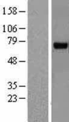 Western Blot: RHOBTB3 Overexpression Lysate [NBL1-15353]