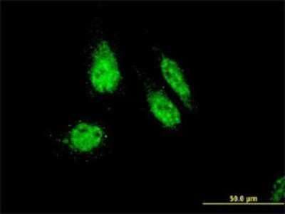 Immunocytochemistry/ Immunofluorescence: RHOXF1 Antibody (4D12) [H00158800-M01]