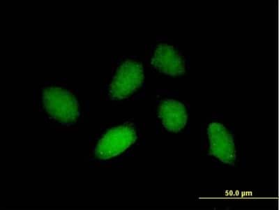 Immunocytochemistry/ Immunofluorescence: RHOXF1 Antibody [H00158800-B01P]