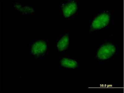 Immunocytochemistry/ Immunofluorescence: RHOXF2 Antibody [H00084528-B02P]