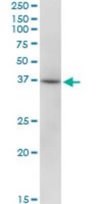 Western Blot: RHOXF2 Antibody [H00084528-B01P]
