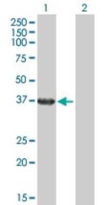 Western Blot: RHOXF2 Antibody [H00084528-B02P]