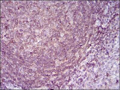 Immunohistochemistry: RIAM/APBB1IP Antibody (7E7D12) - BSA Free [NBP2-52416]