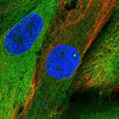 Immunocytochemistry/ Immunofluorescence: RIAM/APBB1IP Antibody [NBP2-14300]