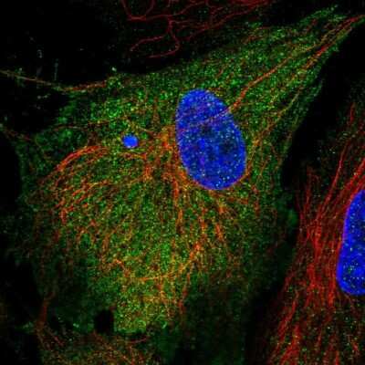Immunocytochemistry/ Immunofluorescence: RIAM/APBB1IP Antibody [NBP2-39009]