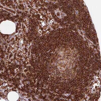 Immunohistochemistry-Paraffin: RIAM/APBB1IP Antibody [NBP2-39009]