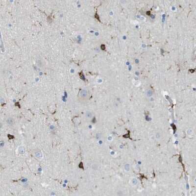 Immunohistochemistry-Paraffin: RIAM/APBB1IP Antibody [NBP2-14300]