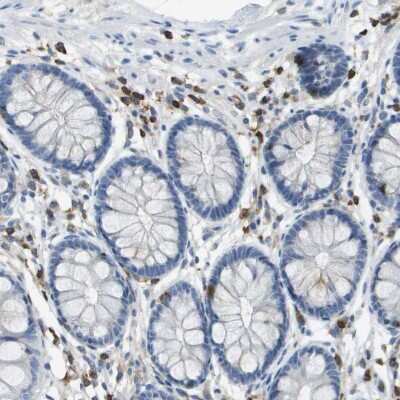 Immunohistochemistry-Paraffin: RIAM/APBB1IP Antibody [NBP2-14300]