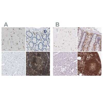 Immunohistochemistry-Paraffin: RIAM/APBB1IP Antibody [NBP2-14300]
