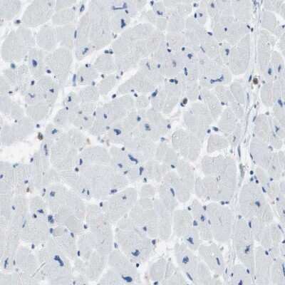 Immunohistochemistry-Paraffin: RIAM/APBB1IP Antibody [NBP2-14300]