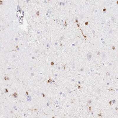 Immunohistochemistry-Paraffin: RIAM/APBB1IP Antibody [NBP2-39009]