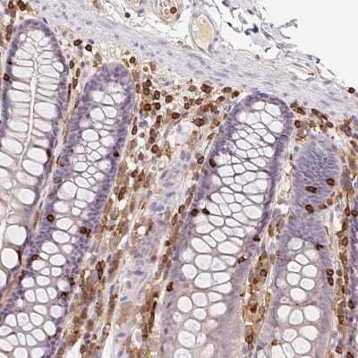 Immunohistochemistry-Paraffin: RIAM/APBB1IP Antibody [NBP2-39009]