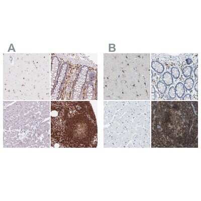 Immunohistochemistry-Paraffin: RIAM/APBB1IP Antibody [NBP2-39009]