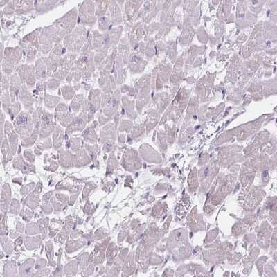 Immunohistochemistry-Paraffin: RIAM/APBB1IP Antibody [NBP2-39009]
