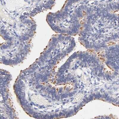 Immunohistochemistry-Paraffin: RIBC2 Antibody [NBP1-86814]