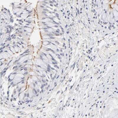 Immunohistochemistry-Paraffin: RIBC2 Antibody [NBP1-86814]