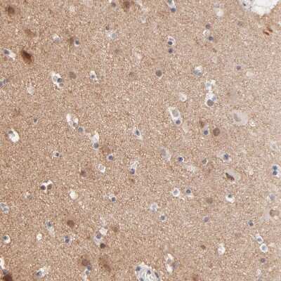 Immunohistochemistry-Paraffin: RIBC2 Antibody [NBP1-86814]