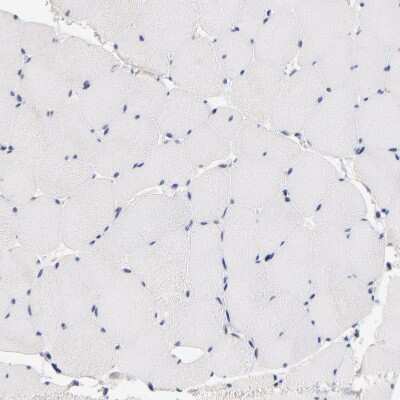 Immunohistochemistry-Paraffin: RIBC2 Antibody [NBP1-86814]