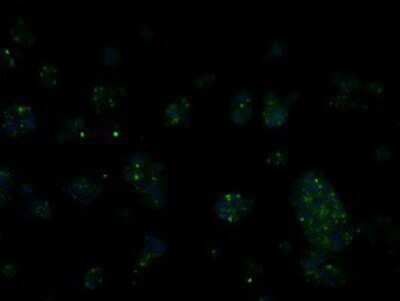 Immunocytochemistry/ Immunofluorescence: RIC8A Antibody (OTI3G3) - Azide and BSA Free [NBP2-73908]