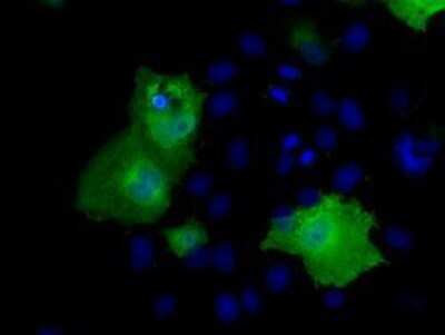 Immunocytochemistry/ Immunofluorescence: RIC8A Antibody (OTI3G3) - Azide and BSA Free [NBP2-73908]