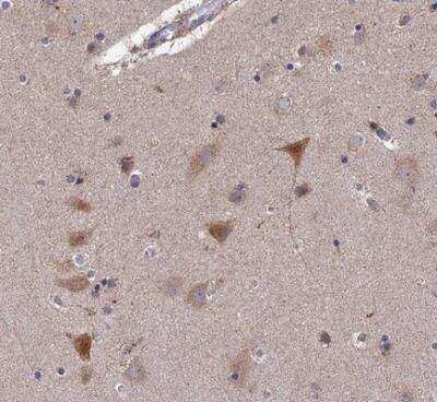 Immunohistochemistry-Paraffin: RIC8B Antibody [NBP2-13232]