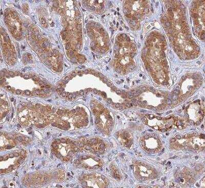 Immunohistochemistry-Paraffin: RIC8B Antibody [NBP2-13232]