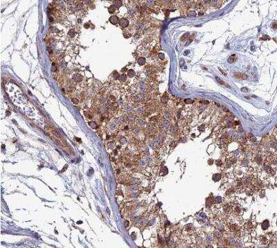 Immunohistochemistry-Paraffin: RIC8B Antibody [NBP2-13232]