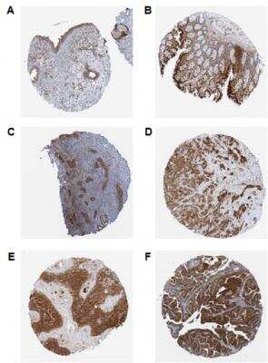 Immunohistochemistry-Paraffin: RIG-I Antibody (Alme-1) - BSA Free [NBP2-80055]