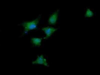 Immunocytochemistry/ Immunofluorescence: RIG-I Antibody (OTI6C1) - Azide and BSA Free [NBP2-73909]