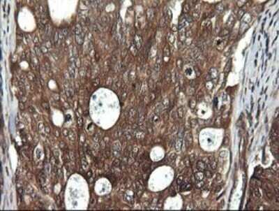 Immunohistochemistry: RIG-I Antibody (OTI6C1) - Azide and BSA Free [NBP2-73909]