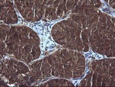 Immunohistochemistry: RIG-I Antibody (OTI6C1) [NBP2-45678]