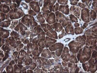 Immunohistochemistry: RIG-I Antibody (OTI6C1) [NBP2-45678]