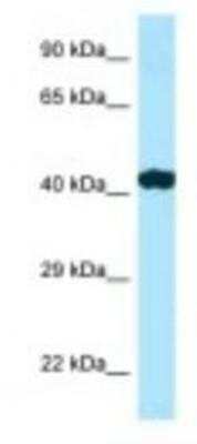 Western Blot: RILP Antibody [NBP1-98278]