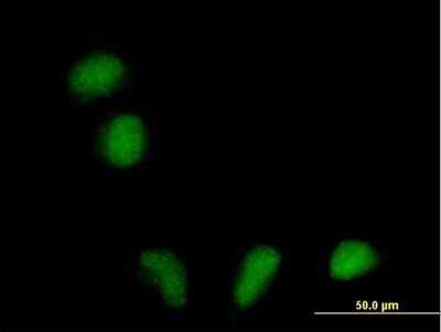 Immunocytochemistry/ Immunofluorescence: RILPL1 Antibody [H00353116-B01P]