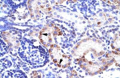 Immunohistochemistry: RIMS3 Antibody [NBP2-85639]