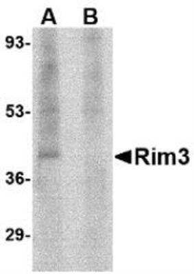 Western Blot: RIMS3 Antibody Blocking Peptide [NBP1-76874PEP]