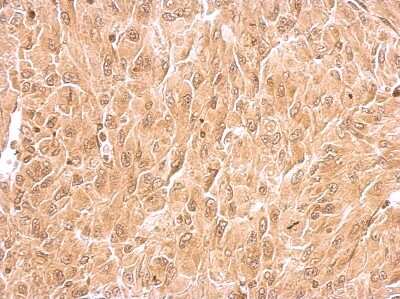 Immunohistochemistry-Paraffin: RIN2 Antibody [NBP2-20163]