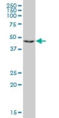 Western Blot: RING1 Antibody (1D5) [H00006015-M09]