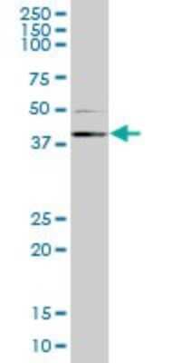 Western Blot: RING1 Antibody (1F4) [H00006015-M10]