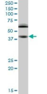 Western Blot: RING1 Antibody (2B3) [H00006015-M03]