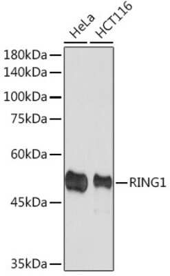 Western Blot: RING1 Antibody (2Q8D5) [NBP3-15893]