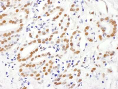 Immunohistochemistry: RING1 Antibody [NBP2-04111]