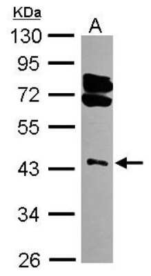 Western Blot: RING1 Antibody [NBP2-20164]