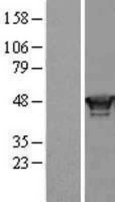 Western Blot: RING1 Overexpression Lysate [NBL1-15372]