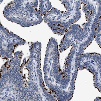 Immunohistochemistry-Paraffin: RINT1 Antibody [NBP1-82312]