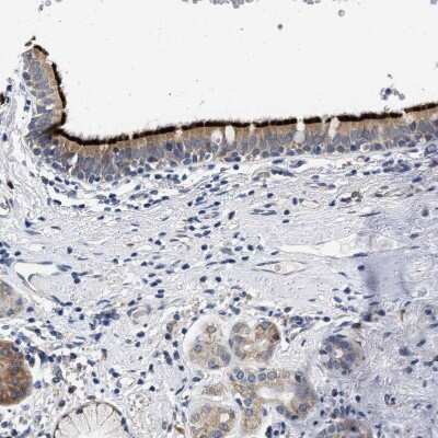 Immunohistochemistry-Paraffin: RINT1 Antibody [NBP1-82312]