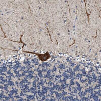 Immunohistochemistry-Paraffin: RINT1 Antibody [NBP1-82312]
