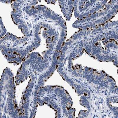 Immunohistochemistry-Paraffin: RINT1 Antibody [NBP1-82312]