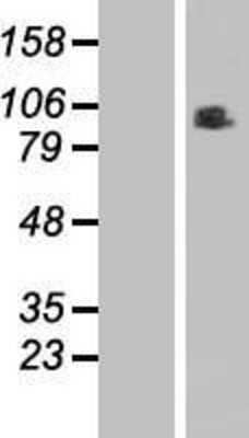 Western Blot: RINT1 Overexpression Lysate [NBL1-15373]