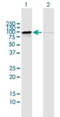 Western Blot: RIOK1 Antibody [H00083732-B02P]